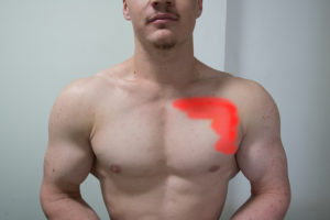 Physiotheray Rothwell Blog Ball smash example